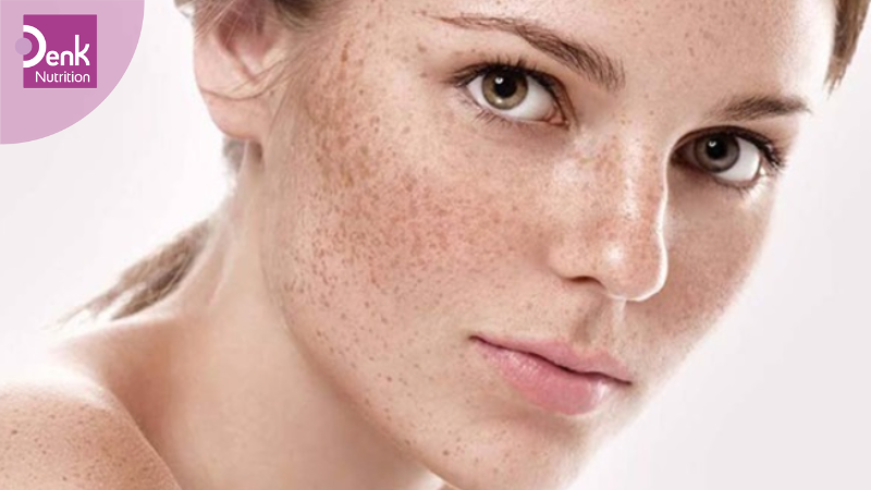 Giảm tình trạng sạm da, dưỡng trắng