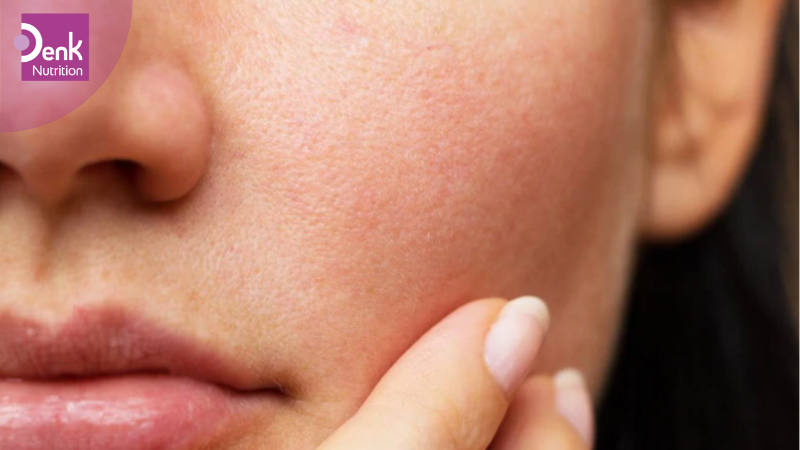 Giảm tình trạng khô ráp