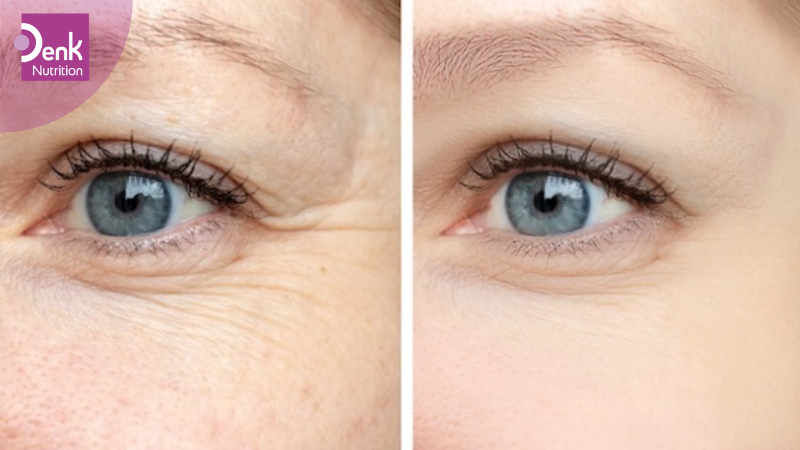 Làm mờ nếp nhăn