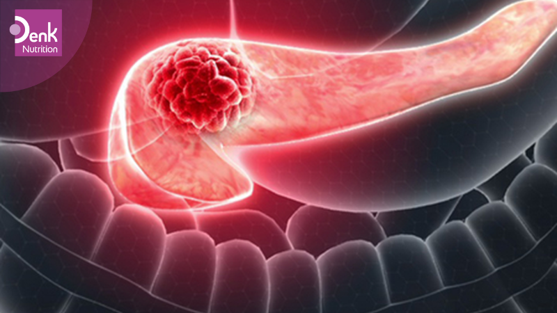 Nguy cơ làm tăng khả năng tái phát ung thư