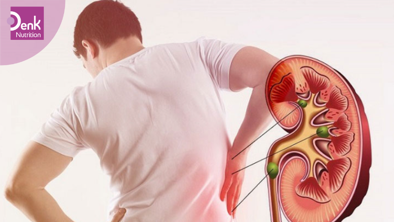 Hỗ trợ điều trị bệnh thận nghiêm trọng