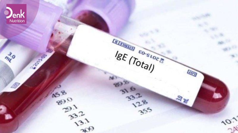 Các xét nghiệm thường dùng (test dị ứng, IgE, test loại trừ,...)