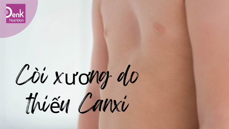 Thiếu canxi