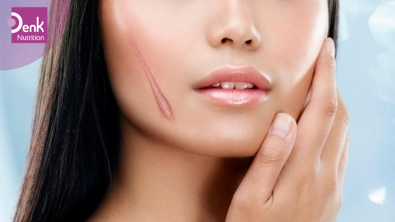 Đẩy nhanh quá trình phục hồi vết thương