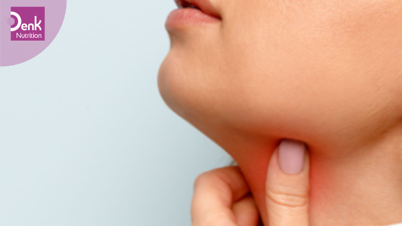 Phòng ngừa bướu giáp