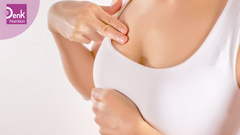 Hỗ trợ điều trị bệnh xơ nang tuyến vú