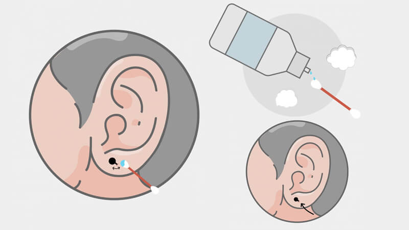Vệ sinh mặt trước và mặt sau lỗ xỏ với nước muối sinh lý