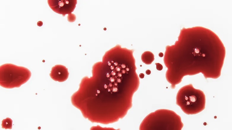 Chất chống đông máu có thể gây nên hiện tượng chảy máu không cầm được khi phẫu thuật