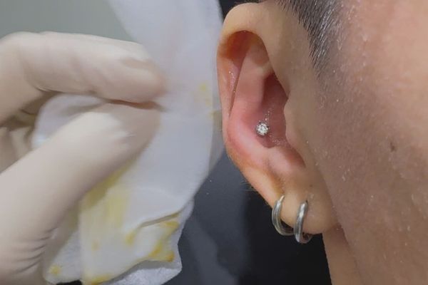 Lỗ xỏ 1 tuần tháo khuyên ra vệ sinh được không?