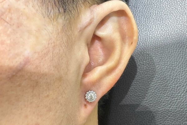 Ảnh bạn nam xỏ thịt tai tại TinyBox 9/2024