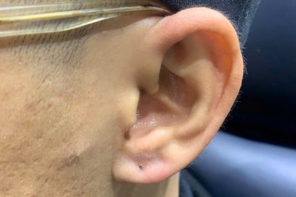 Ảnh bạn nam xỏ thịt tai tại TinyBox 9/2024