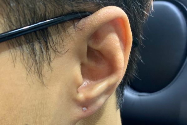 Ảnh bạn nam xỏ thịt tai tại TinyBox 9/2024