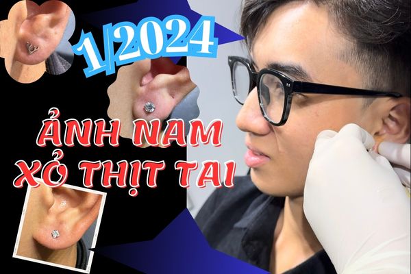 Ảnh nam xỏ thịt tai