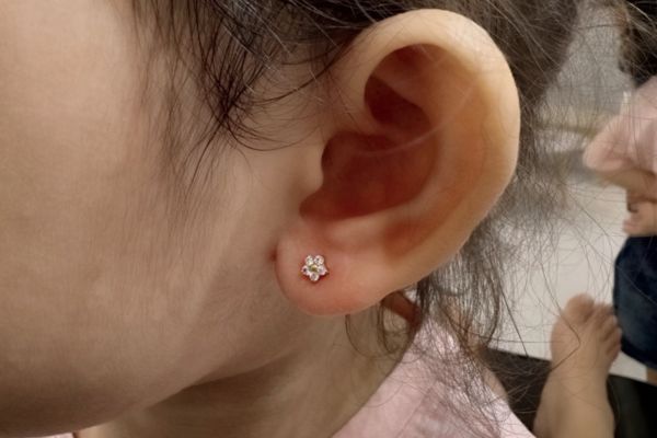 Ảnh trẻ em xỏ khuyên tai