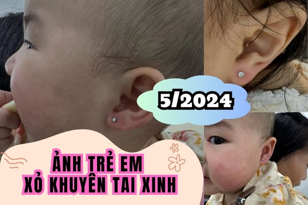 Ảnh trẻ em xỏ khuyên tai dễ thương tại TinyBox 5/2024