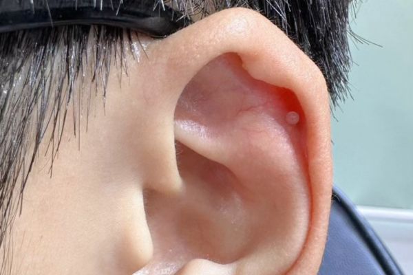 Ảnh xỏ khuyên sụn tai cho nam tại TinyBox - 9/2023