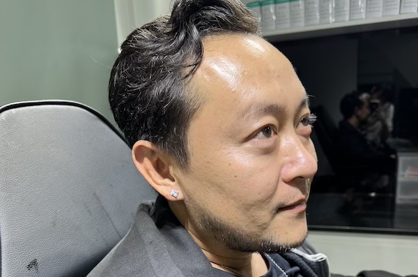 Ảnh xỏ tai nam đẹp 4//2023 thực hiện tại TinyBox - Tp.HCM