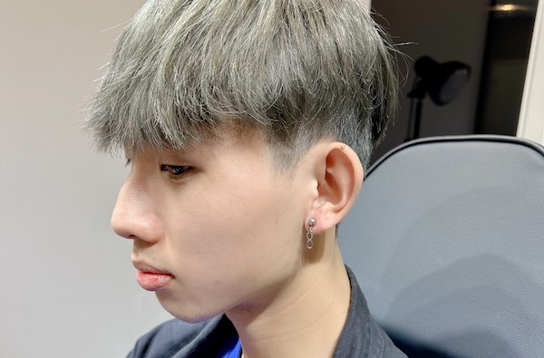 Bấm lỗ tai ăn trứng được không?