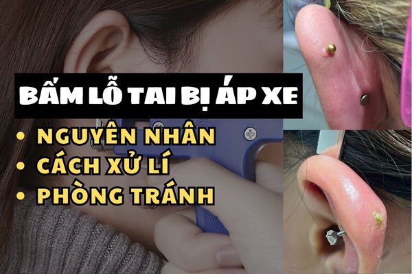 Bấm lỗ tai bị áp xe