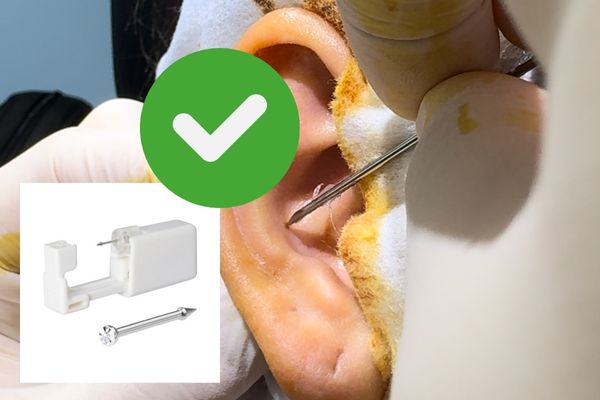 Bấm lỗ tai bị áp xe