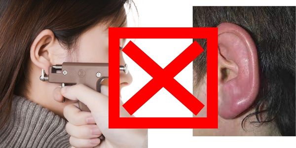 Bấm lỗ tai chảy mủ phải làm sao? Nguyên nhân & cách xử lí vô cùng hiệu quả
