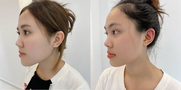 Bấm lỗ tai mấy ngày thì đeo khuyên được