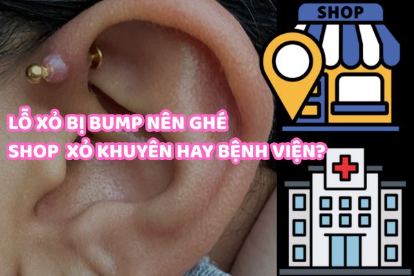 Bị bump lỗ xỏ nên ghé shop xỏ khuyên hay bệnh viện?