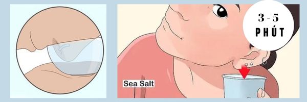 Bị bump lỗ xỏ phải làm sao