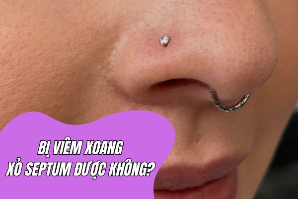 Bị viêm xoang xỏ septum được không?