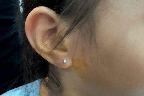 Bộ sưu tập ảnh em bé xỏ khuyên tại TinyBox mới nhất 6/2024