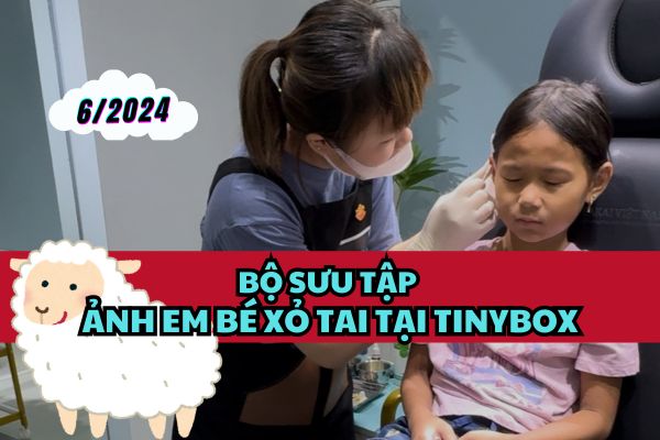 Bộ sưu tập ảnh em bé xỏ khuyên tại TinyBox mới nhất 6/2024
