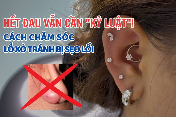 Hết đau vẫn cần "kỷ luật"! Cách chăm sóc lỗ xỏ tránh sẹo lồi