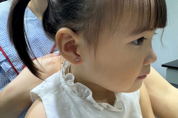 Cách chăm sóc sau khi bấm tai cho bé chi tiết A - Z