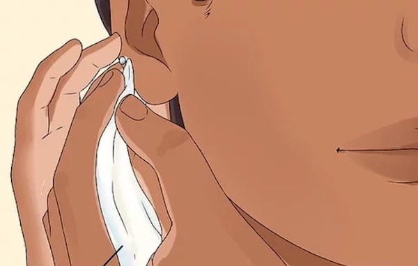 Cách chữa xỏ khuyên sụn tai bị sưng hiệu quả tại nhà