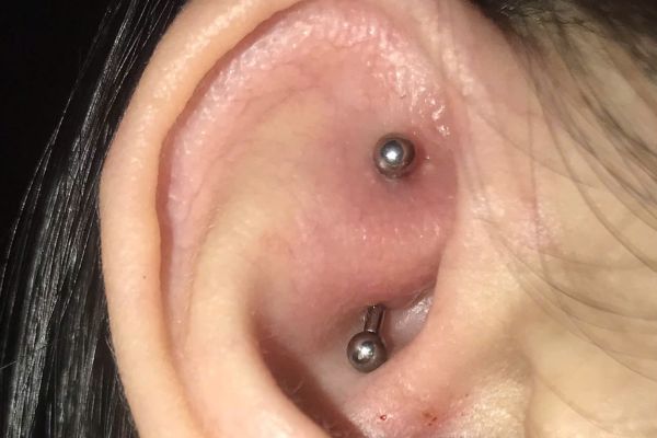 Cách tháo khuyên chốt dẹp tại nhà