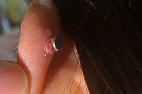 Cách tháo khuyên chốt dẹp tại nhà