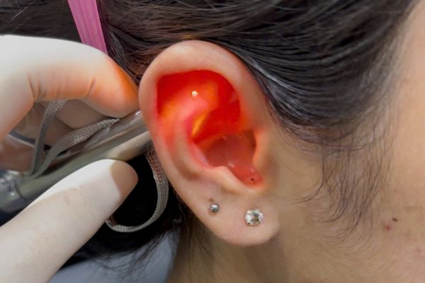 Cách tháo khuyên chốt dẹp tại nhà