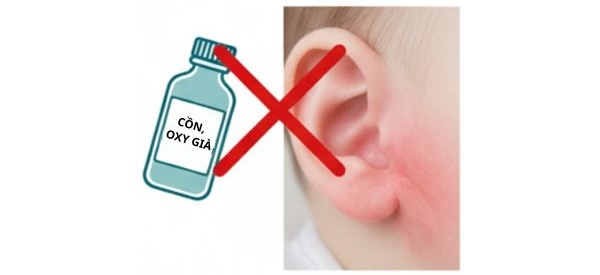 KHÔNG dùng cồn hoặc oxy già khi vệ sinh lỗ xỏ tai cho bé