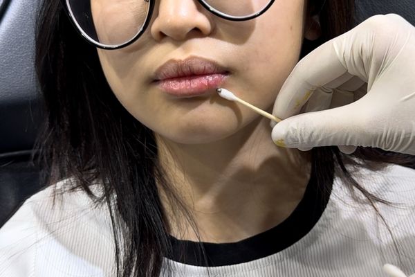 3 cách vệ sinh lỗ xỏ và chiếc khuyên mà không cần tháo ra