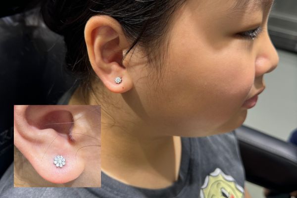 Chọn chất liệu bông tai nào tốt và an toàn cho bé?