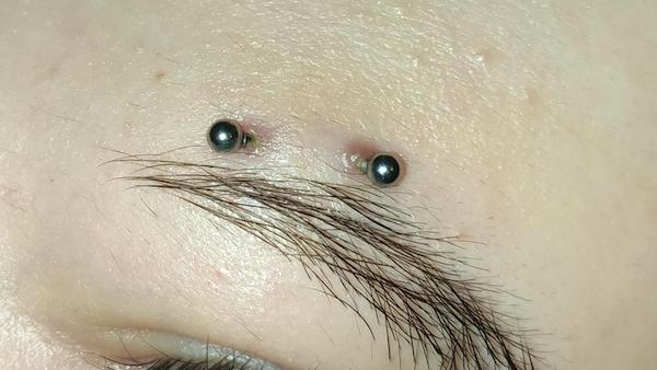 Dấu hiệu nhận biết lỗ xỏ khuyên bị đào thải