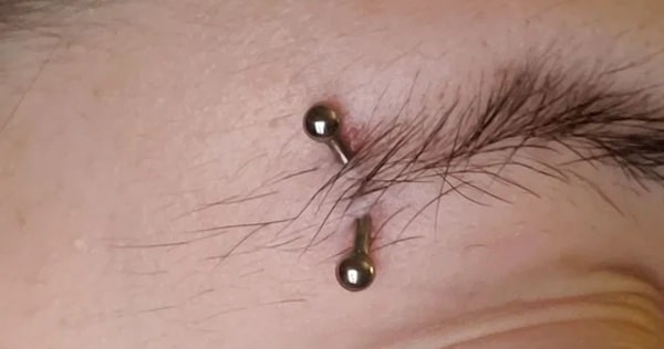 Dấu hiệu nhận biết lỗ xỏ khuyên bị đào thải