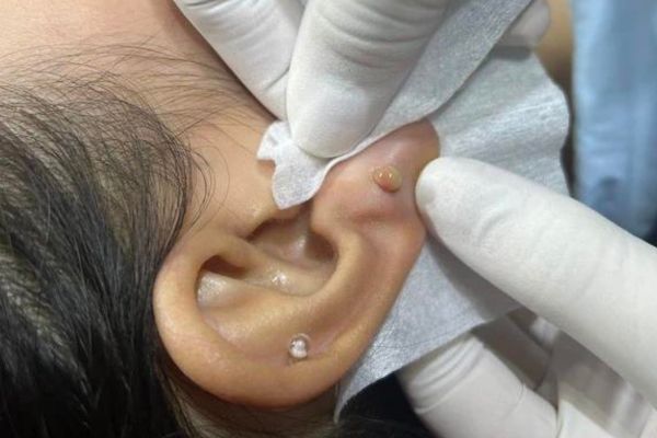 Đeo tăm vào lỗ xỏ khuyên