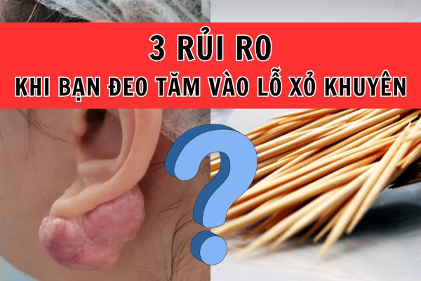 Đeo tăm vào lỗ xỏ khuyên