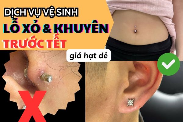Dịch vụ vệ sinh lỗ xỏ và khuyên trước Tết giá hạt dẻ