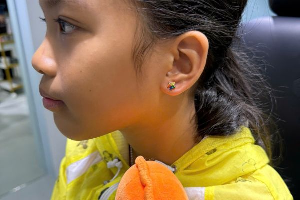 Dùng cồn 70 độ rửa lỗ xỏ khuyên được không?