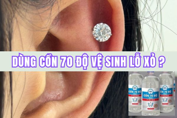 Dùng cồn 70 độ rửa lỗ xỏ khuyên được không?