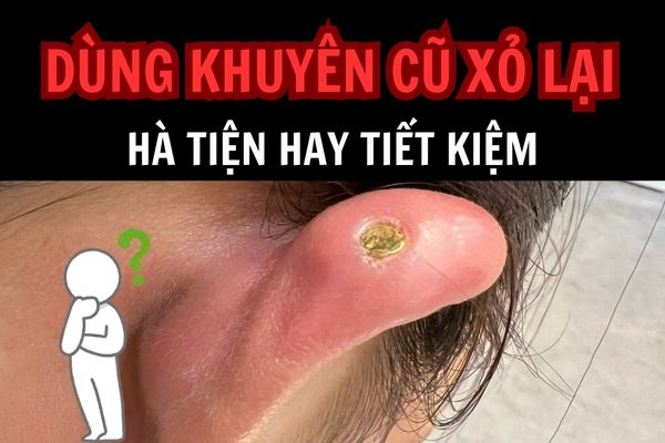 Dùng khuyên cũ xỏ lại được không?