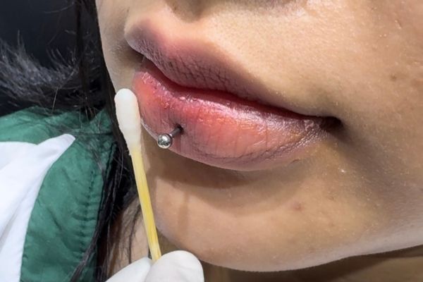 Dùng Oxy già rửa lỗ xỏ khuyên được không?