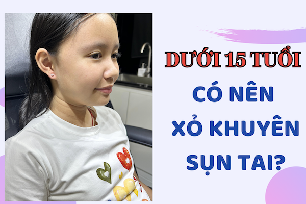 Dưới 15 tuổi xỏ khuyên sụn tai được không